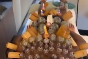 神秘疗法曝光！30岁奥纳纳全身拔罐疗伤，肩部至小腿罐印密布
