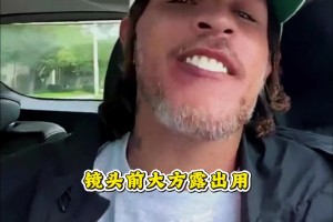 韦斯特终于是好起来了！镜头前大方露出用第一笔报酬换的新牙...